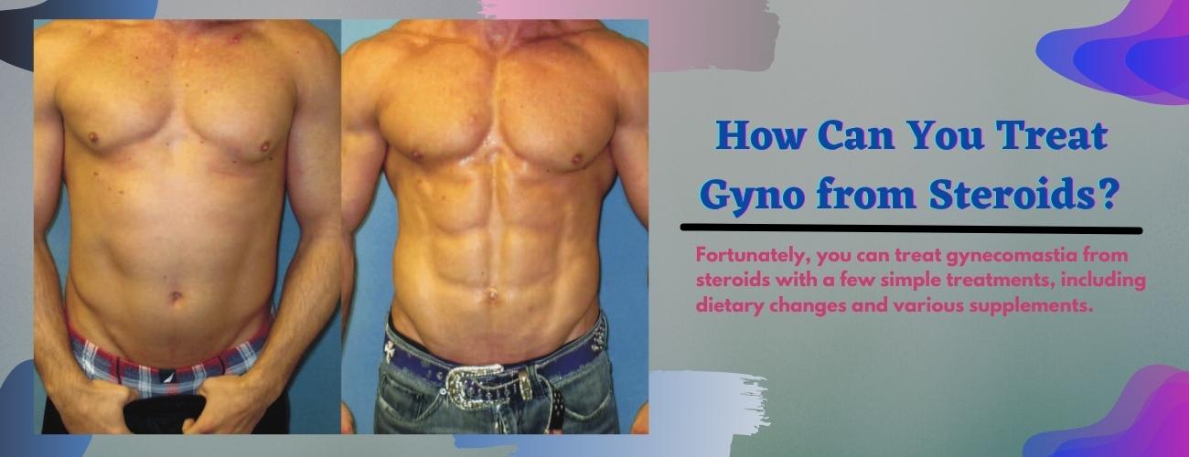 How Can You Treat Gyno from Steroide?